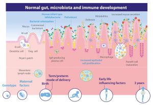 Gut health and immune system